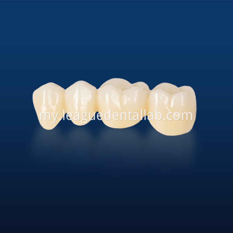 UTML zirconia,Katana zirconia,Esthetic zirconia,SHTML zirconia,3D Multilayered Zirconia